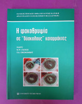 Η φακοθρυψία σε δύσκολους καταρράκτες