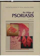 An Atlas of Psoriasis