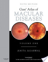 Gass' Atlas of Macular Diseases