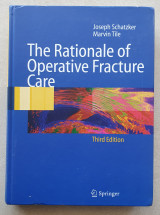 The rationale of operative fracture care