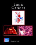 Lung Cancer