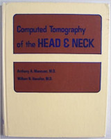 Computed Tomography of the Head and Neck