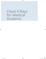 Chest X-Rays for Medical Students