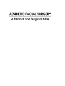 Aesthetic facial surgery