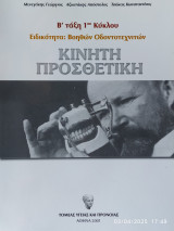 Κινητική προσθετική