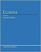 Eczema