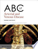 ABC of Arterial and Venous Disease