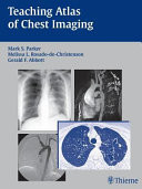 Teaching Atlas of Chest Imaging